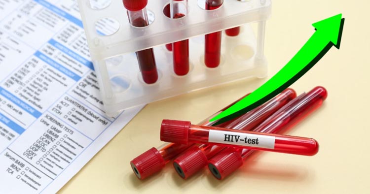 Sudden Increase in HIV Cases in Bangladesh