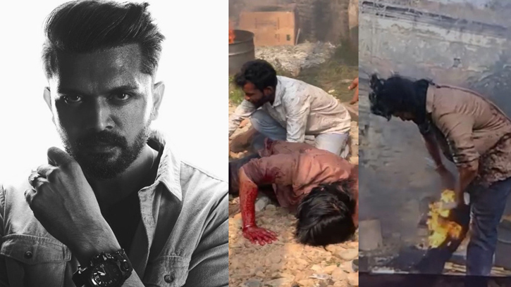 শুটিং সেটে দুর্ঘটনা, অগ্নিদগ্ধ আরিফিন শুভ