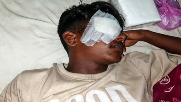 স্বেচ্ছাসেবক দলের নেতার হামলায় চালকের চোখ নষ্টের অভিযোগ 