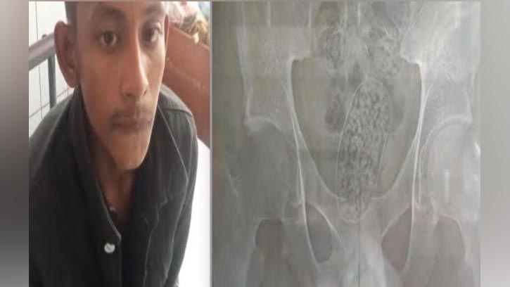 পেটভর্তি ইয়াবাসহ শার্শার মাসুদ রানা আটক