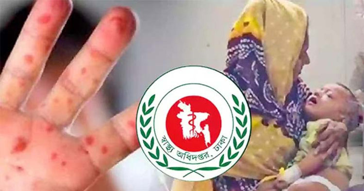 হামে ২৪ ঘণ্টায় ৬ মৃত্যু, নতুন আক্রান্ত ১ হাজার ৩১৬