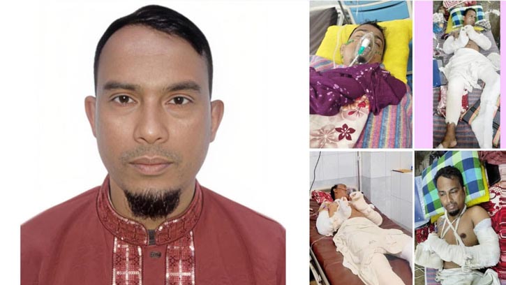 সন্ত্রাসী হামলা: অসহ্য যন্ত্রনায় জীবন কাটাচ্ছেন সাংবাদিক বাছিত