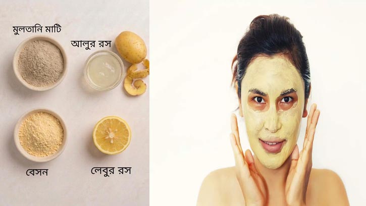 ঘরোয়া ফেসপ্যাকেই দূর হবে রোদে পোড়া দাগ
