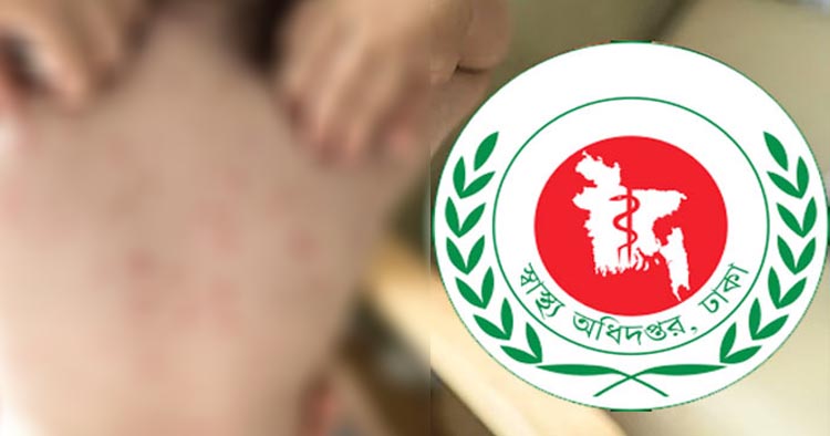দেশে হামের থাবা, ১৫ মার্চের পর প্রাণ গেল ৭৯৭ শিশুর