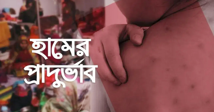 হামে বাড়ছে মৃত্যু, সন্দেহভাজন ও নিশ্চিত মিলিয়ে ৬৪২ জনের প্রাণহানি